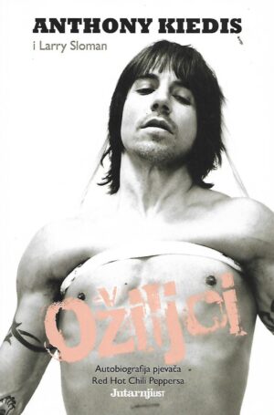 anthony kiedis, larry sloman: ožiljci